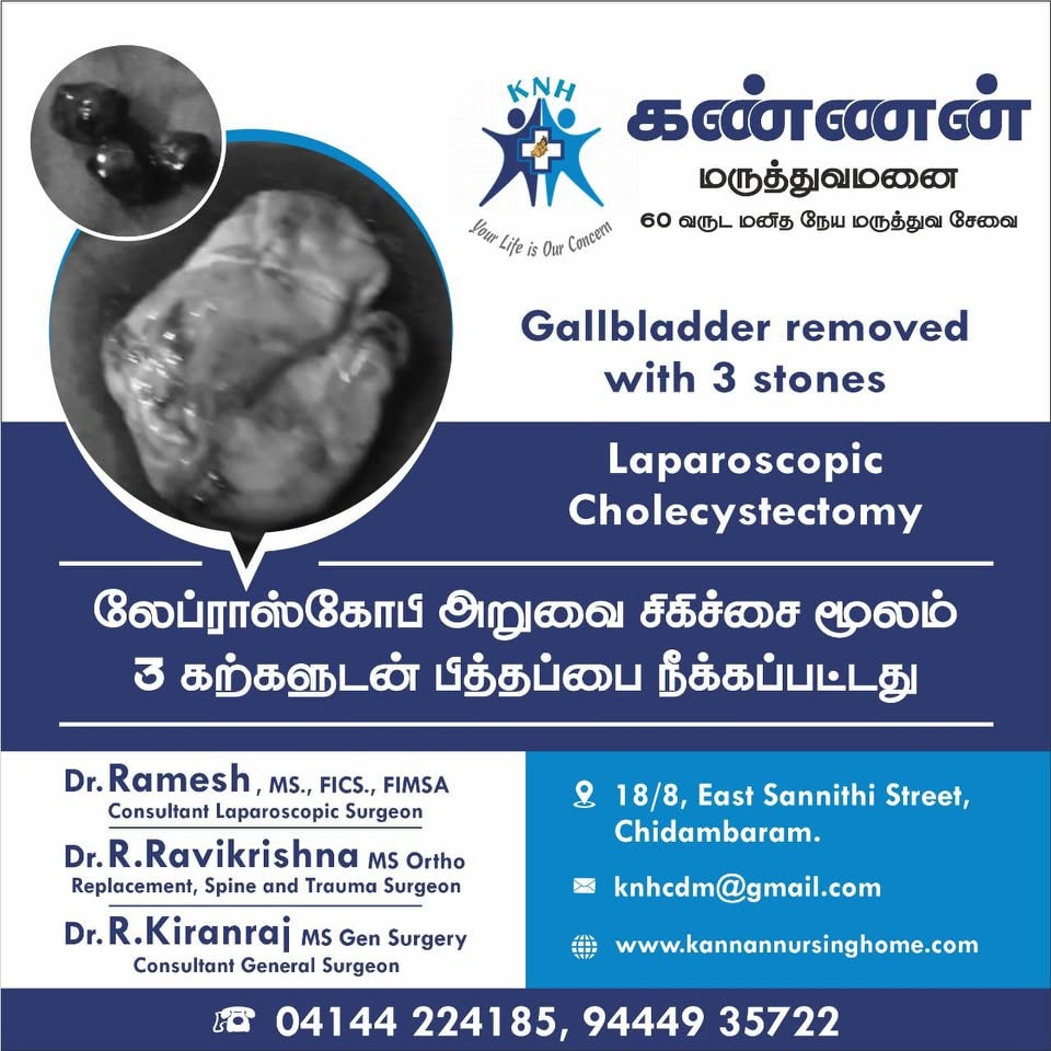 Laparoscopic Surgery in Chidambaram - Kannan Nursing Home